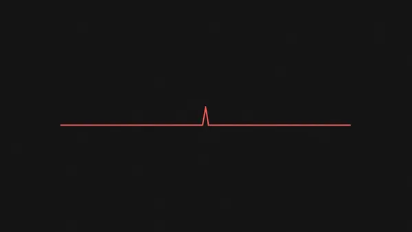 A flat line with one sharp vertical spike